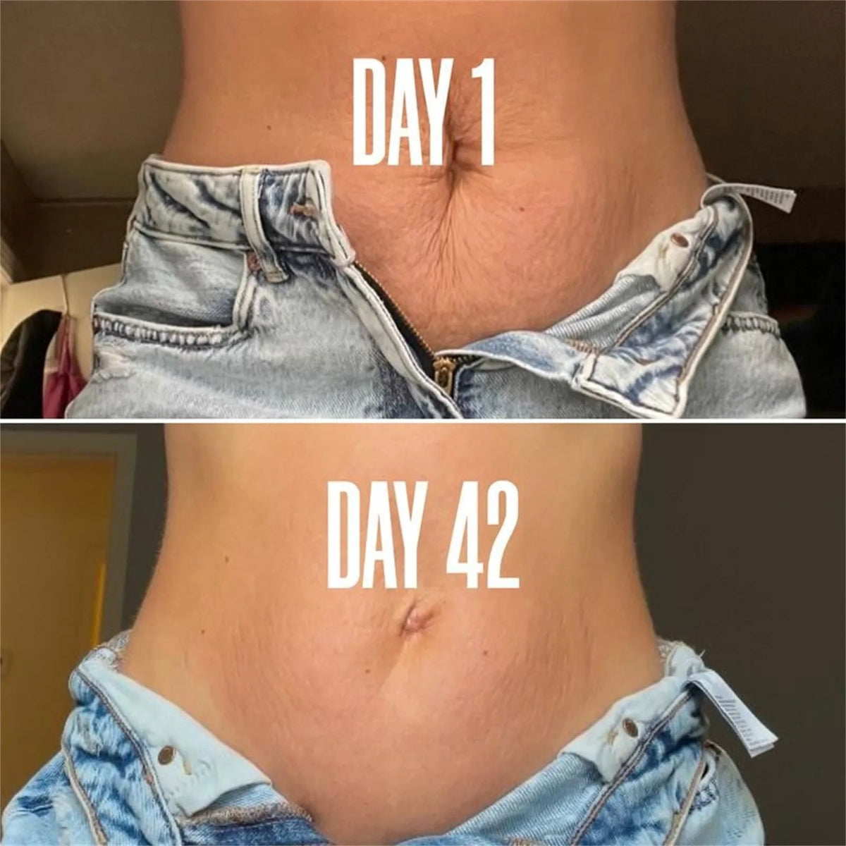 Stretch Marks Cream | 2 + 1 FREE | Bundle