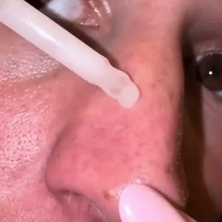 Peel Shot Glow Rice Ampoule Duo by Wowgood